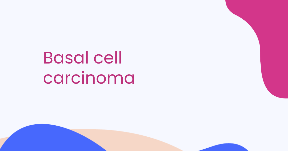 Carcinoma basocelular